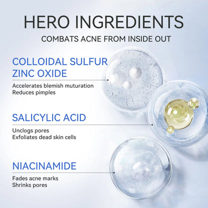 Emergency Acne Control for Sudden Breakouts